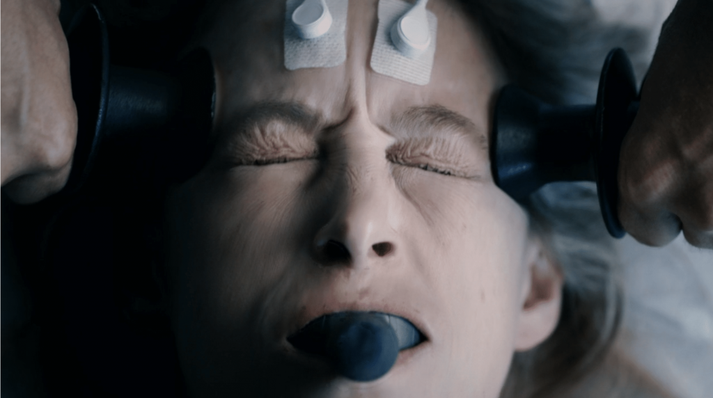 Electrochoque – en España aumentan y Reino Unido trabaja en prohibirlos